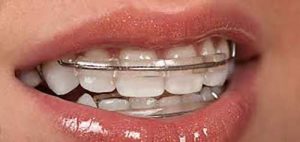 dentist in Paschim Vihar Delhi