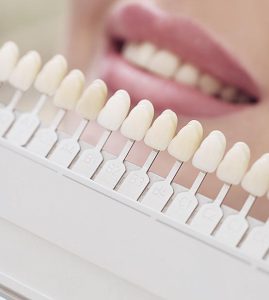 teeth whitening in kirti nagar