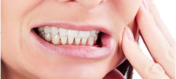 bruxism treatment in kirti nagar